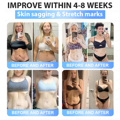 FDA Store |𝐵uil𝗱𝐿ea𝐟® 𝑮𝐋𝑃-1 Slim & Firm 𝑁ano 𝑀icroneedle 𝑃atch with Collagen,Turmeric&Matrixyl 3000 丨Obesity,Cardiovascular Diseas, Diabetes, Sleep Apnea, Joint Problems and More