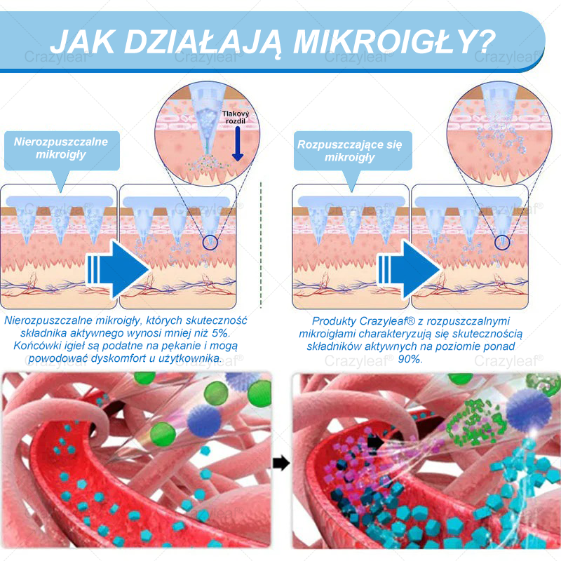 ✨𝐂𝐫𝐚𝐳𝐲𝐋𝐞𝐚𝐟® 𝐒𝐌𝐆𝐓-𝐆𝐋𝐏-𝟏 𝐏𝐥𝐚𝐬𝐭𝐫𝐲 – 𝐒𝐩𝐚𝐥𝐚𝐧𝐢𝐞 𝐭ł𝐮𝐬𝐳𝐜𝐳𝐮, 𝐔𝐣ę𝐝𝐫𝐧𝐢𝐞𝐧𝐢𝐞, 𝐏𝐨𝐳𝐢𝐨𝐦 𝐜𝐮𝐤𝐫𝐮 • 𝐄𝐟𝐞𝐤𝐭𝐲 𝐰 𝟕 𝐝𝐧𝐢, 𝐛𝐞𝐳 𝐳𝐚𝐬𝐭𝐫𝐳𝐲𝐤ó𝐰