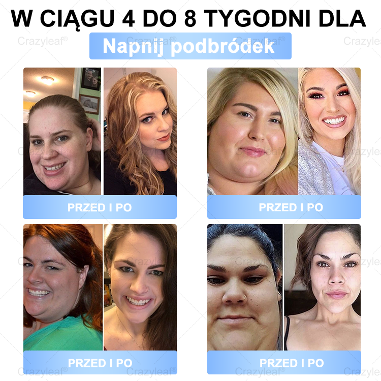 ✨𝐂𝐫𝐚𝐳𝐲𝐋𝐞𝐚𝐟® 𝐒𝐌𝐆𝐓-𝐆𝐋𝐏-𝟏 𝐏𝐥𝐚𝐬𝐭𝐫𝐲 – 𝐒𝐩𝐚𝐥𝐚𝐧𝐢𝐞 𝐭ł𝐮𝐬𝐳𝐜𝐳𝐮, 𝐔𝐣ę𝐝𝐫𝐧𝐢𝐞𝐧𝐢𝐞, 𝐏𝐨𝐳𝐢𝐨𝐦 𝐜𝐮𝐤𝐫𝐮 • 𝐄𝐟𝐞𝐤𝐭𝐲 𝐰 𝟕 𝐝𝐧𝐢, 𝐛𝐞𝐳 𝐳𝐚𝐬𝐭𝐫𝐳𝐲𝐤ó𝐰