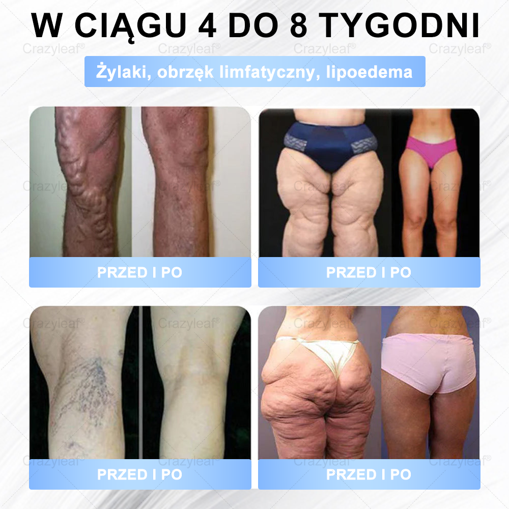 ✨𝐂𝐫𝐚𝐳𝐲𝐋𝐞𝐚𝐟® 𝐒𝐌𝐆𝐓-𝐆𝐋𝐏-𝟏 𝐏𝐥𝐚𝐬𝐭𝐫𝐲 – 𝐒𝐩𝐚𝐥𝐚𝐧𝐢𝐞 𝐭ł𝐮𝐬𝐳𝐜𝐳𝐮, 𝐔𝐣ę𝐝𝐫𝐧𝐢𝐞𝐧𝐢𝐞, 𝐏𝐨𝐳𝐢𝐨𝐦 𝐜𝐮𝐤𝐫𝐮 • 𝐄𝐟𝐞𝐤𝐭𝐲 𝐰 𝟕 𝐝𝐧𝐢, 𝐛𝐞𝐳 𝐳𝐚𝐬𝐭𝐫𝐳𝐲𝐤ó𝐰