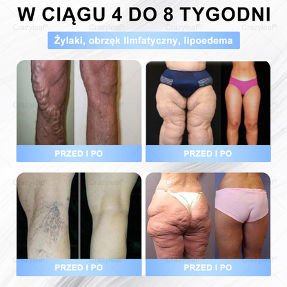 ✨𝐂𝐫𝐚𝐳𝐲𝐋𝐞𝐚𝐟® 𝐒𝐌𝐆𝐓-𝐆𝐋𝐏-𝟏 𝐏𝐥𝐚𝐬𝐭𝐫𝐲 – 𝐒𝐩𝐚𝐥𝐚𝐧𝐢𝐞 𝐭ł𝐮𝐬𝐳𝐜𝐳𝐮, 𝐔𝐣ę𝐝𝐫𝐧𝐢𝐞𝐧𝐢𝐞, 𝐏𝐨𝐳𝐢𝐨𝐦 𝐜𝐮𝐤𝐫𝐮 • 𝐄𝐟𝐞𝐤𝐭𝐲 𝐰 𝟕 𝐝𝐧𝐢, 𝐛𝐞𝐳 𝐳𝐚𝐬𝐭𝐫𝐳𝐲𝐤ó𝐰