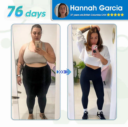 FDA Store |𝐵uil𝗱𝐿ea𝐟® 𝑮𝐋𝑃-1 Slim & Firm 𝑁ano 𝑀icroneedle 𝑃atch with Collagen,Turmeric&Matrixyl 3000 丨Obesity,Cardiovascular Diseas, Diabetes, Sleep Apnea, Joint Problems and More