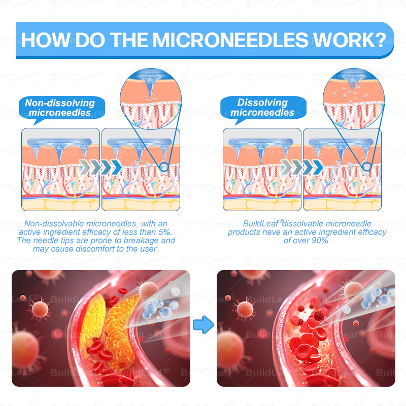 FDA Store |𝐵uil𝗱𝐿ea𝐟® 𝑮𝐋𝑃-1 Slim & Firm 𝑁ano 𝑀icroneedle 𝑃atch with Collagen,Turmeric&Matrixyl 3000 丨Obesity,Cardiovascular Diseas, Diabetes, Sleep Apnea, Joint Problems and More